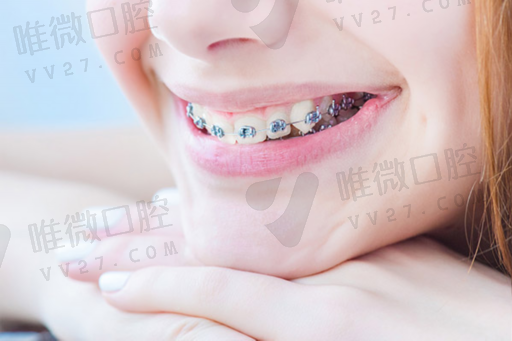 活动义齿的适应症和禁忌症（种植义齿的适应症）(图1)